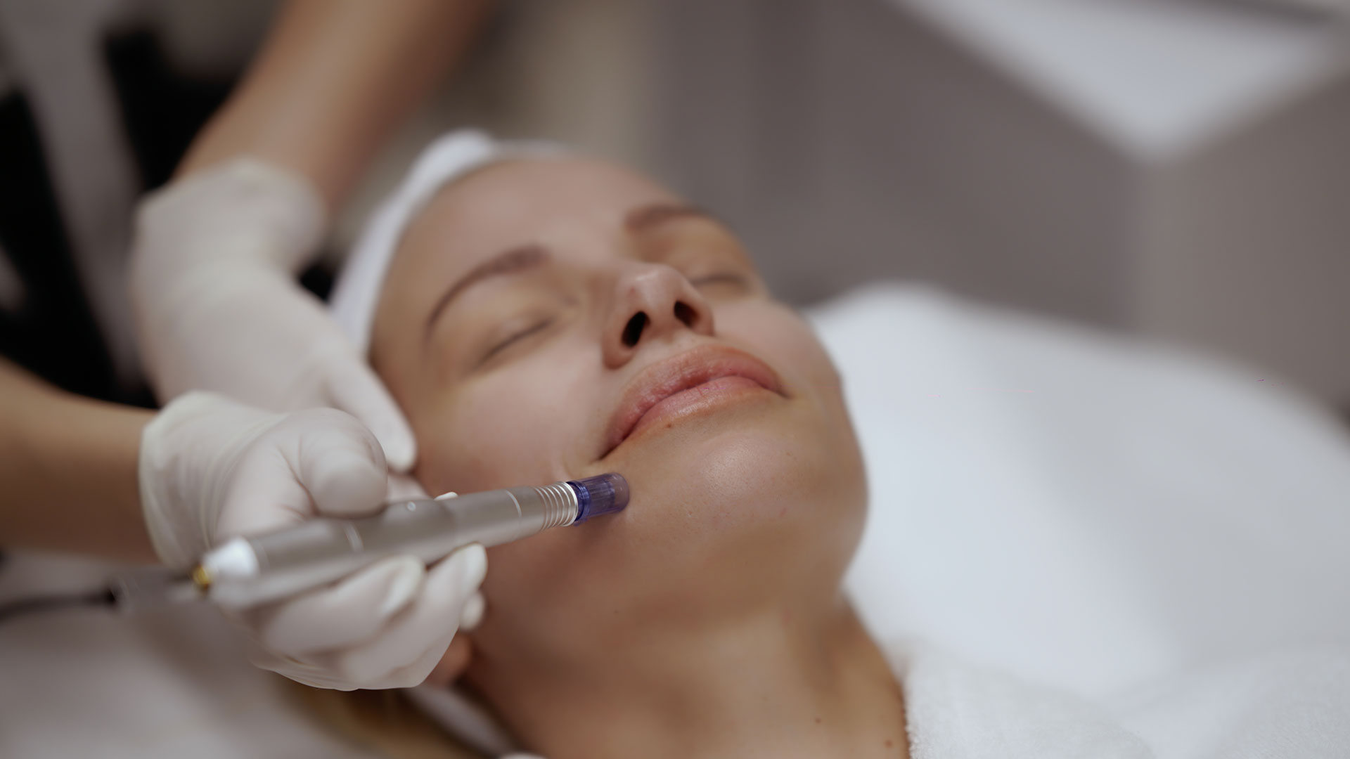dermapen(1)