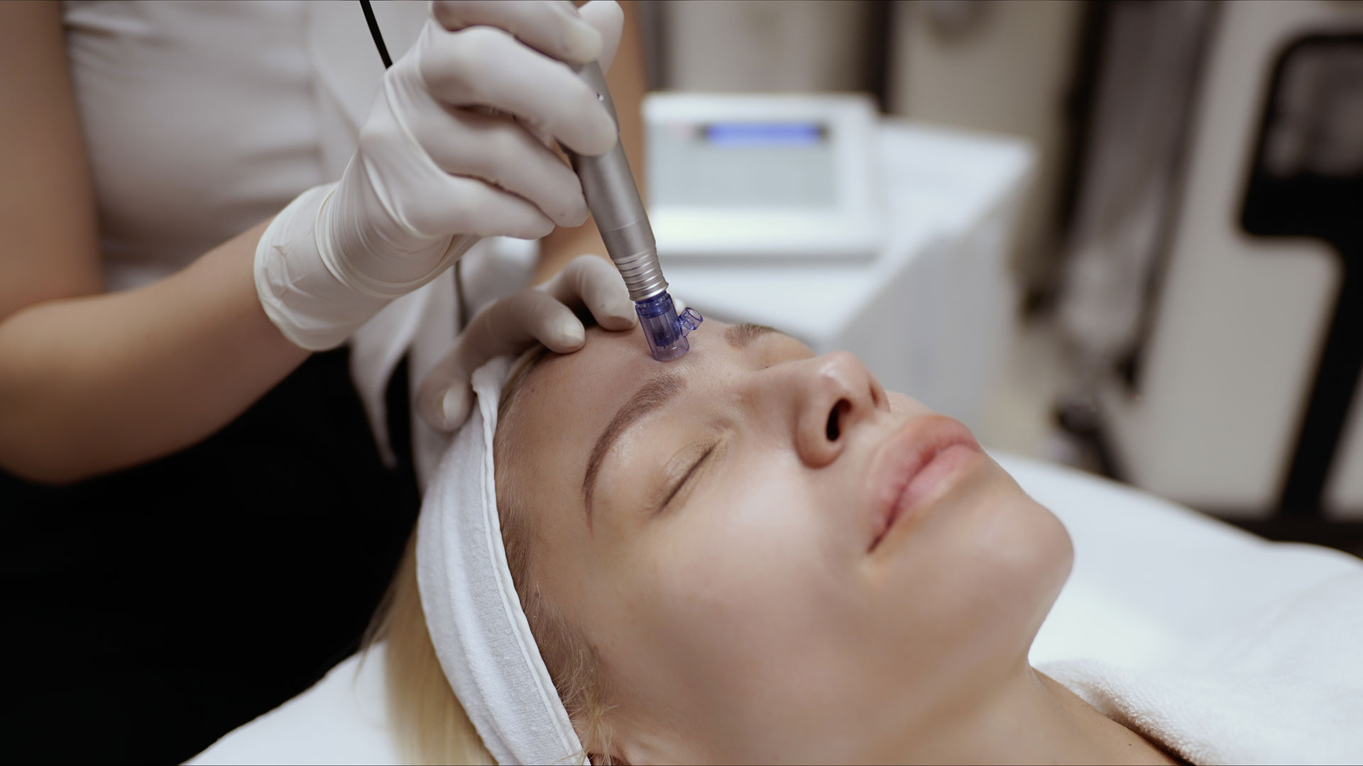 dermapen(3)